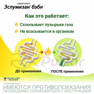 Espumisan™ Baby Oral Drops 100Mg/Ml (50Ml), 1Pc Buy Online 10 Espumisan™ Baby Oral Drops 100Mg/Ml (50Ml), 1Pc Buy Online 9