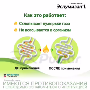 Espumisan™ L Oral Emulsion 40Mg/Ml (30Ml), 1Pc Buy Online 10